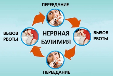 Лечение булимии в Йошкар-Оле